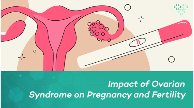 ovarian syndrome